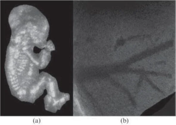 Ultrasonology With 3D Reconstruction